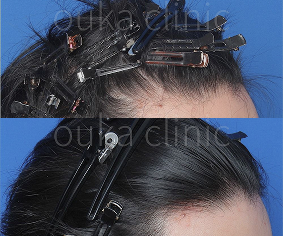 福岡医師の症例