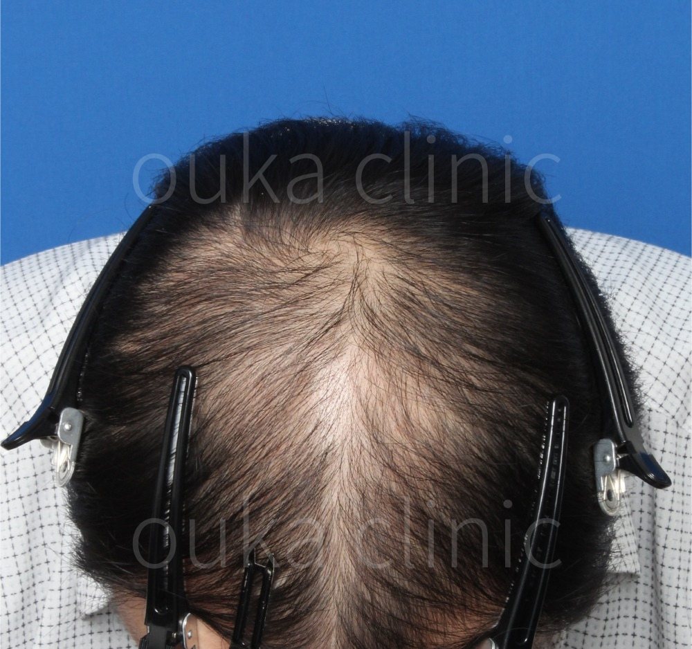 全体の治療前の画像