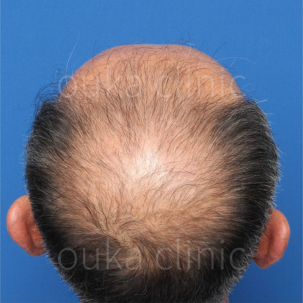 全体の治療前の画像