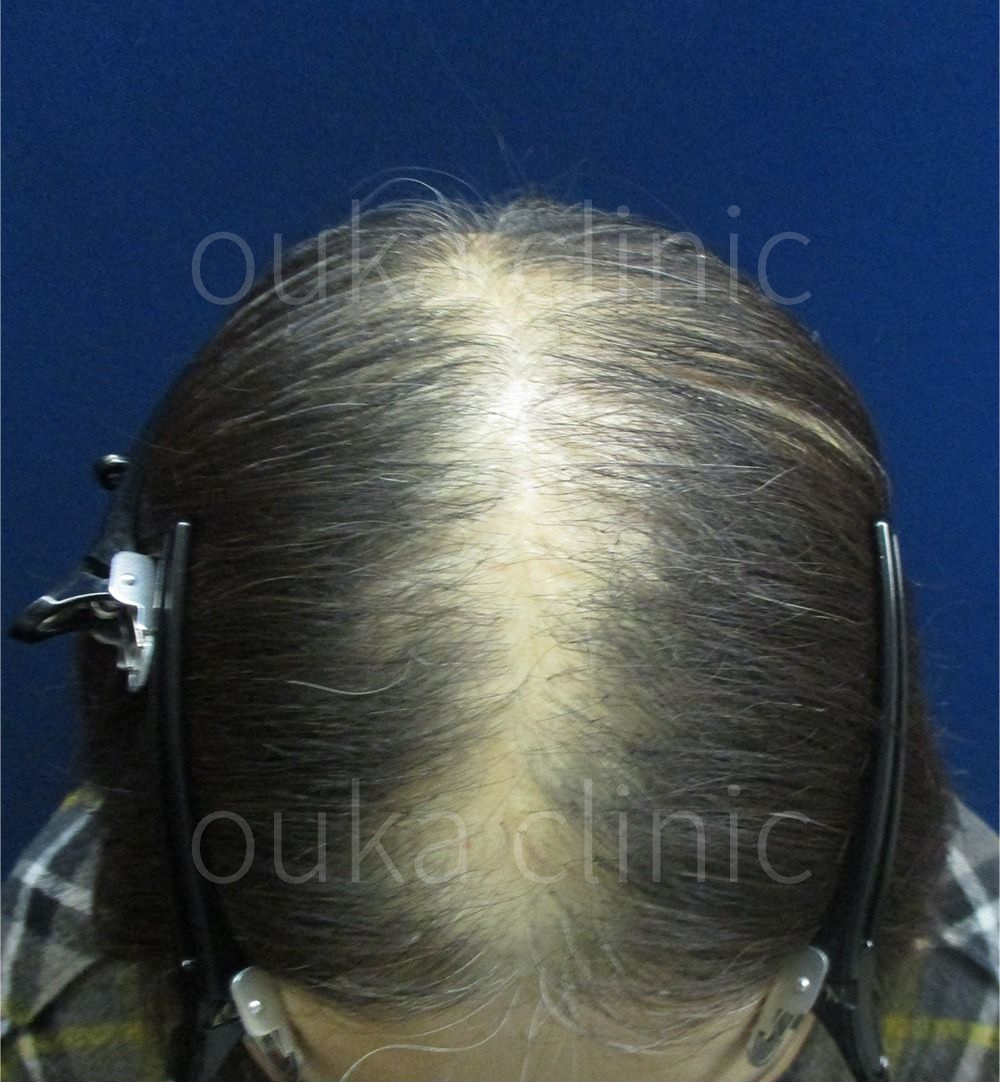 全体の治療前の画像