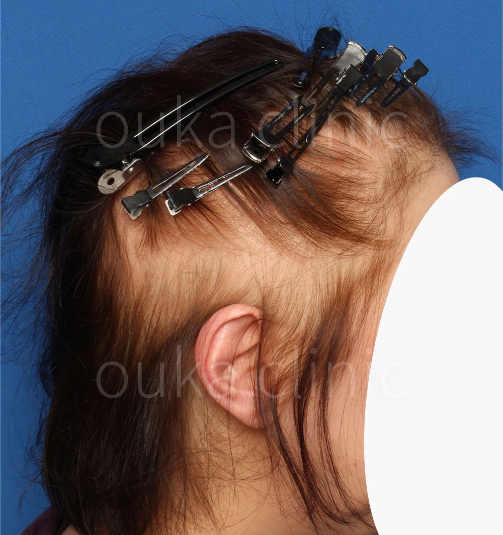 全体の治療前の画像