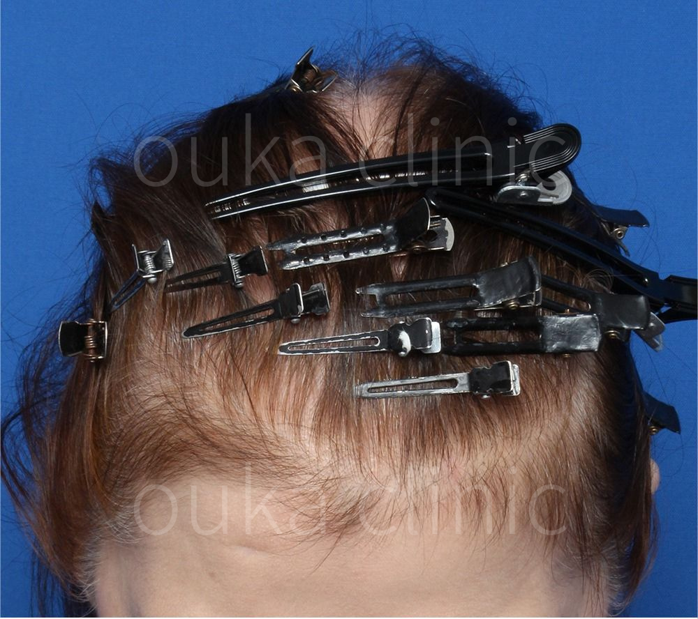 全体の治療前の画像