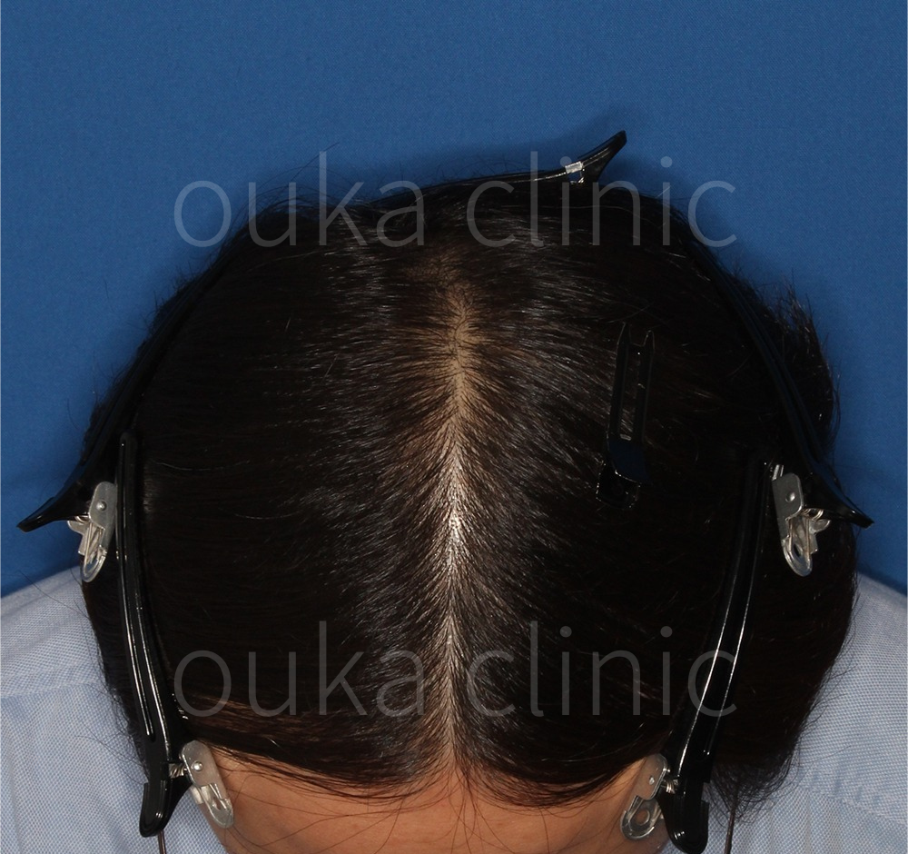 全体の治療後の画像